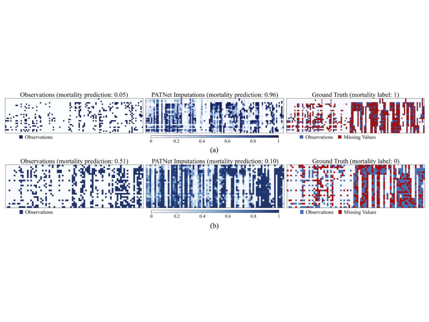 Case study of two patients. PATNet achieves accurate imputation and improves clinical prediction.