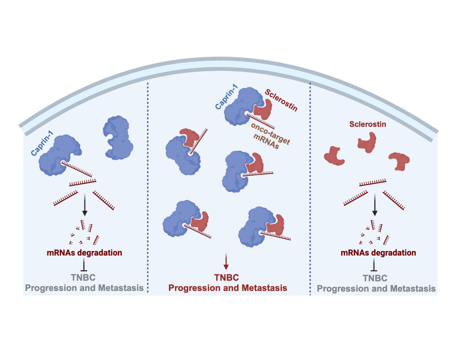 Intracellular sclerostin and caprin1 mutually participated in stabilising oncogenic mRNAs and promoting TNBC progression and metastasis.